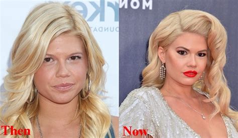 chanel west coast fake hair|chanel west coast plastic surgery.